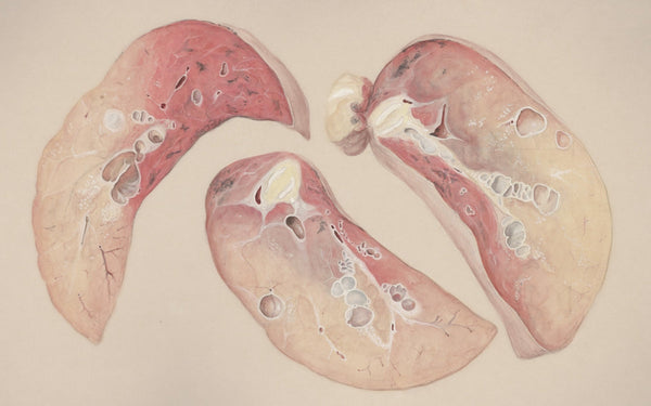 a drawing of a diagram of the lungs