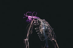 Friedreich's Ataxia and the NDIS