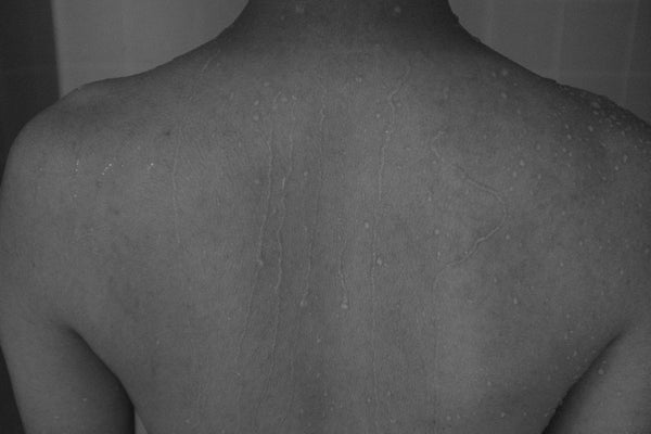 grayscale photography of naked person