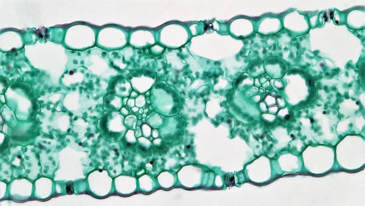 Mitochondrial Disorders and the NDIS - Beyond